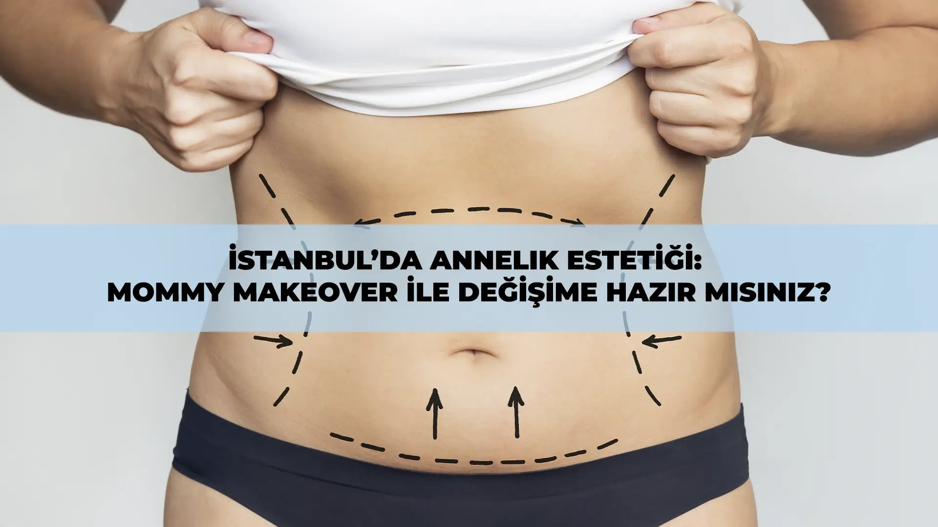 İstanbul’da annelik estetiği (mommy makeover) sonrası fit ve özgüvenli kadın silueti