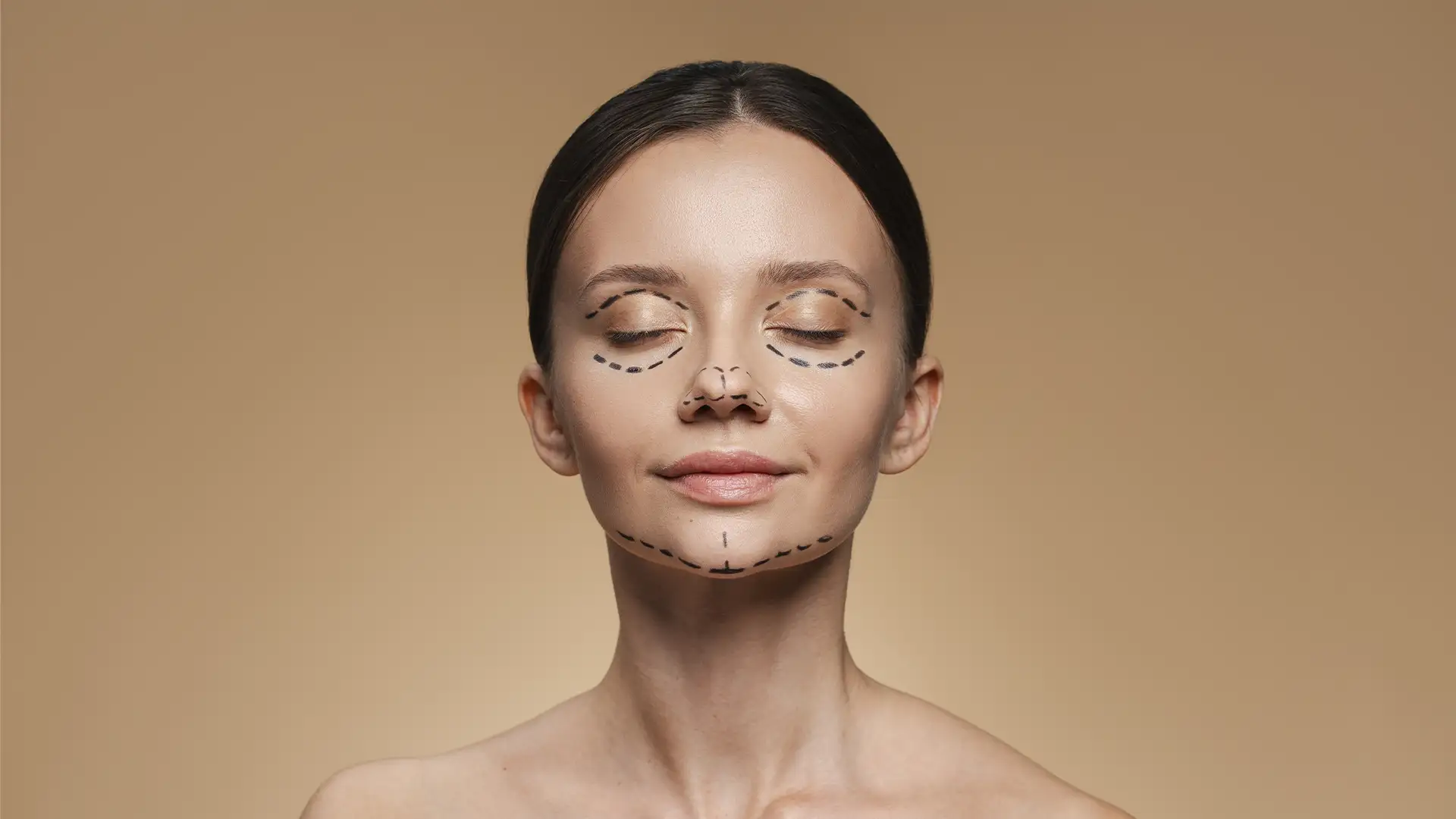 Yüz germe sonrası doğal görünüm ve iyileşme sürecinde mimiklerin korunması