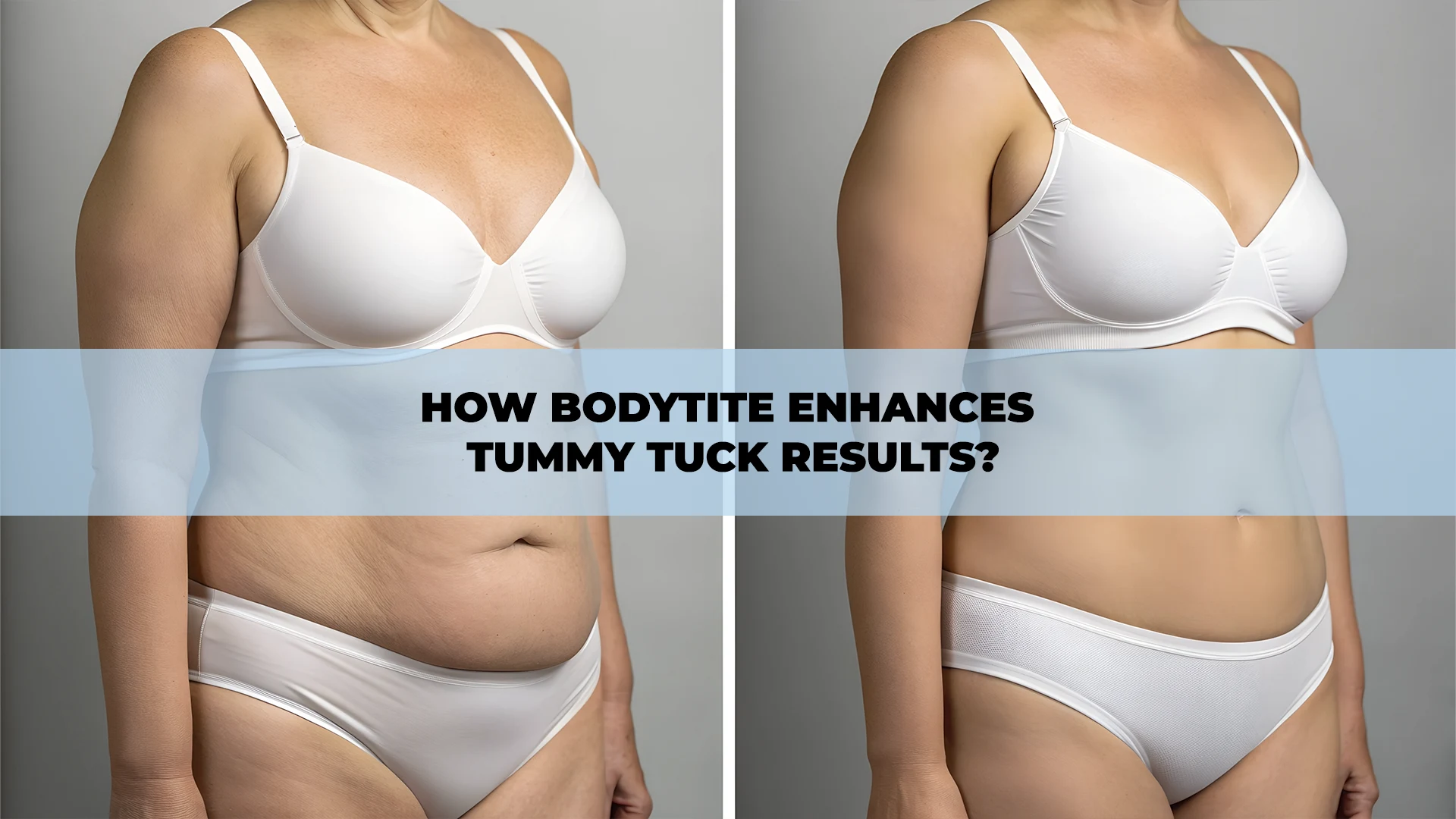 BodyTite procedure enhancing Tummy Tuck results, providing firmer and smoother abdominal contour at a modern aesthetic clinic in Turkey.