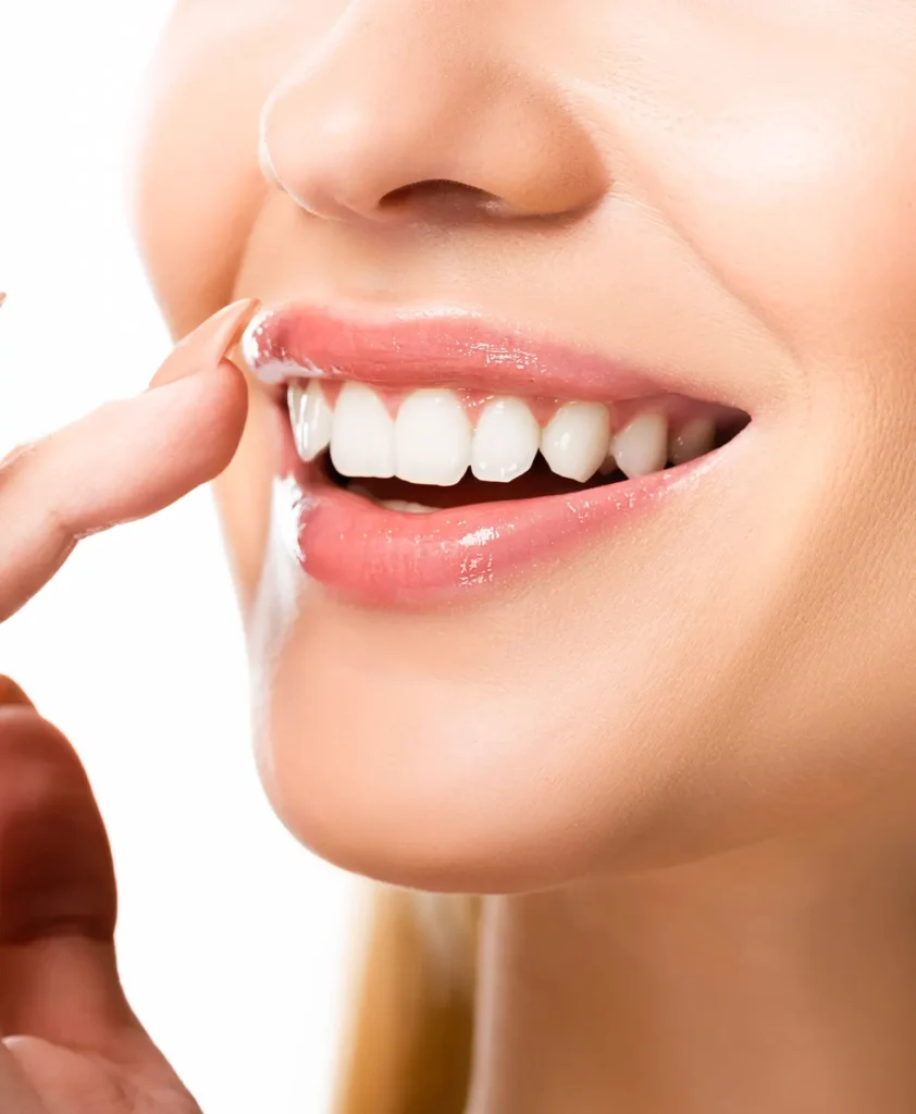Dental Veneers procedure in Turkey ensuring high-quality dental care and long-lasting aesthetic results.