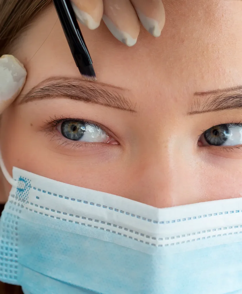 Recovery after Eyebrow Transplant in Turkey with professional care to ensure safe healing and long-lasting results.