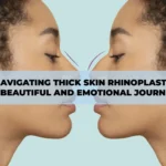 Patient undergoing thick skin rhinoplasty in Turkey, showcasing a transformative and emotional journey with expert aesthetic surgeons.