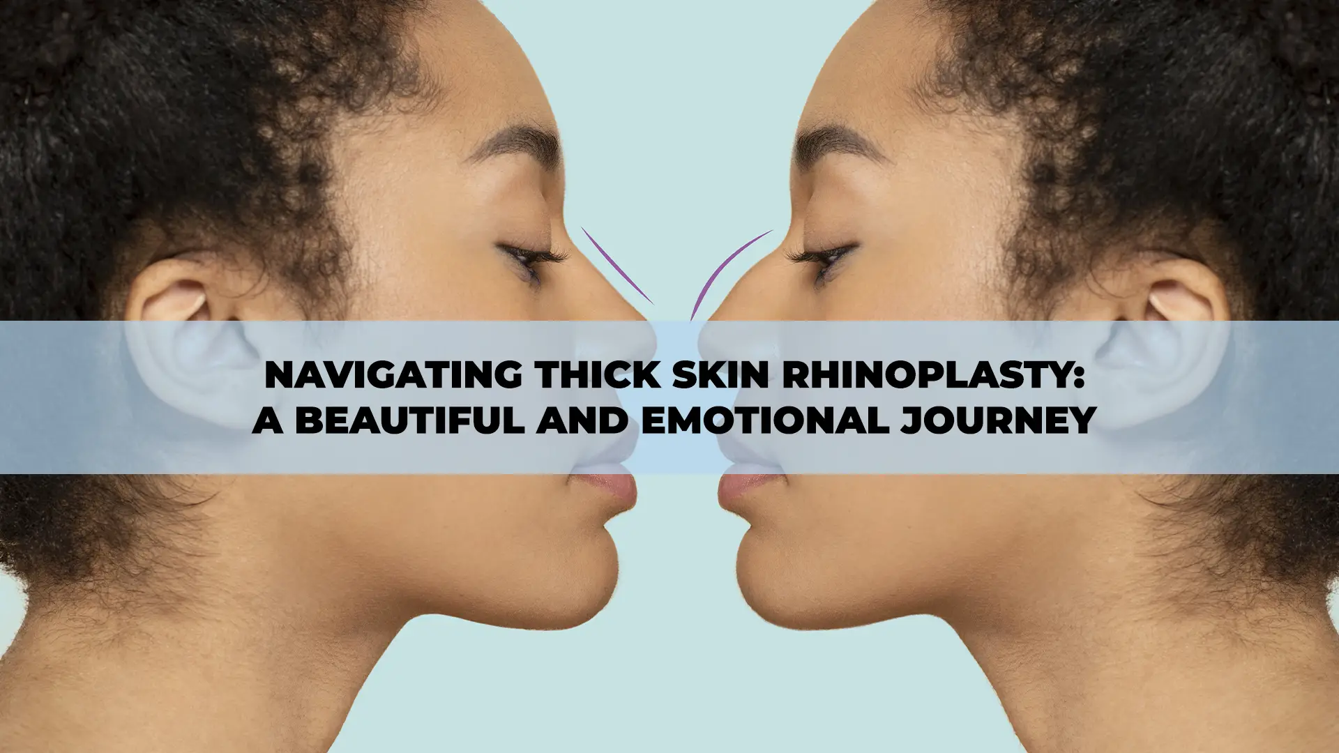 Patient undergoing thick skin rhinoplasty in Turkey, showcasing a transformative and emotional journey with expert aesthetic surgeons.