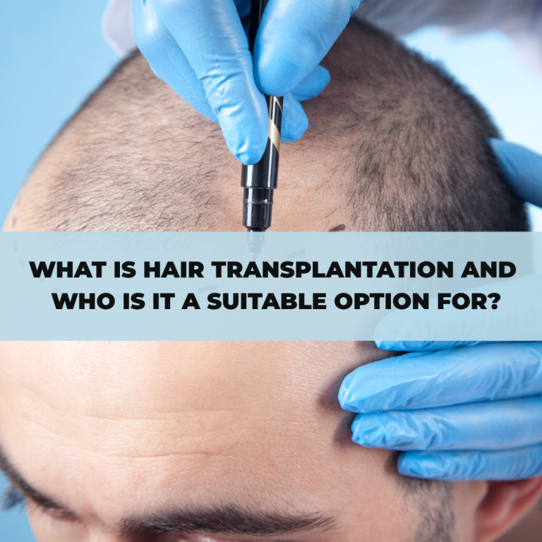What Is Hair Transplantation and Who Is It a Suitable Option For?
