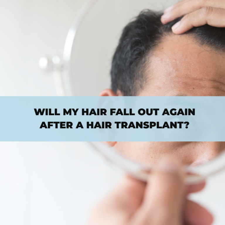 Will My Hair Fall Out Again After a Hair Transplant?