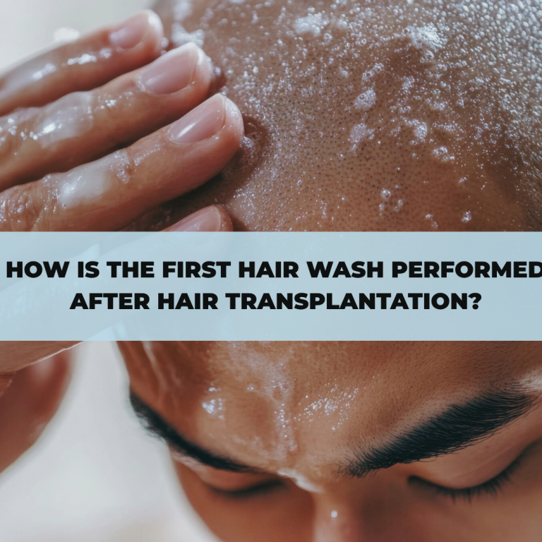 How Is the First Hair Wash Performed After Hair Transplantation