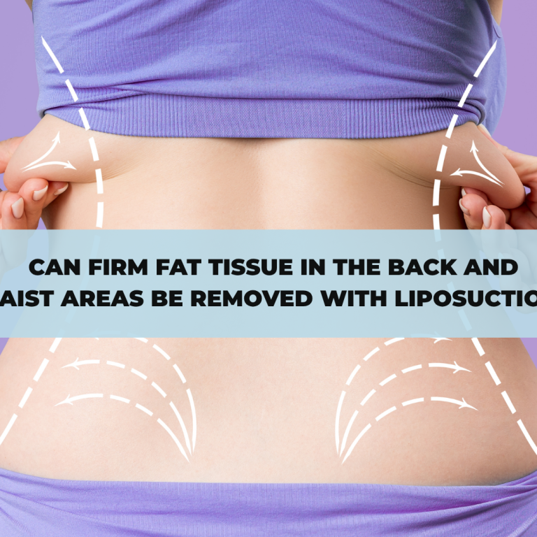 Can Firm Fat Tissue in the Back and Waist Areas Be Removed with Liposuction?