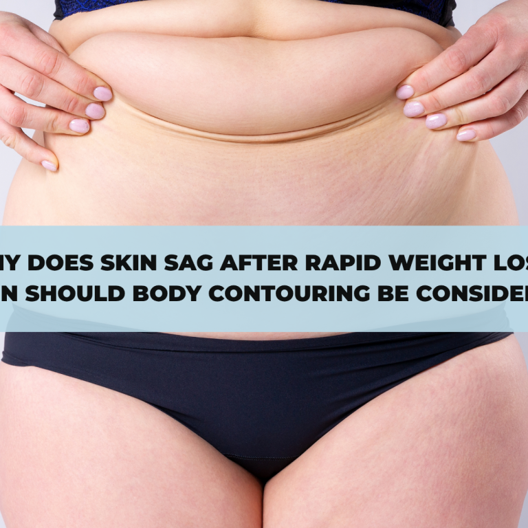 Why Does Skin Sag After Rapid Weight Loss? When Should Body Contouring Be Considered?