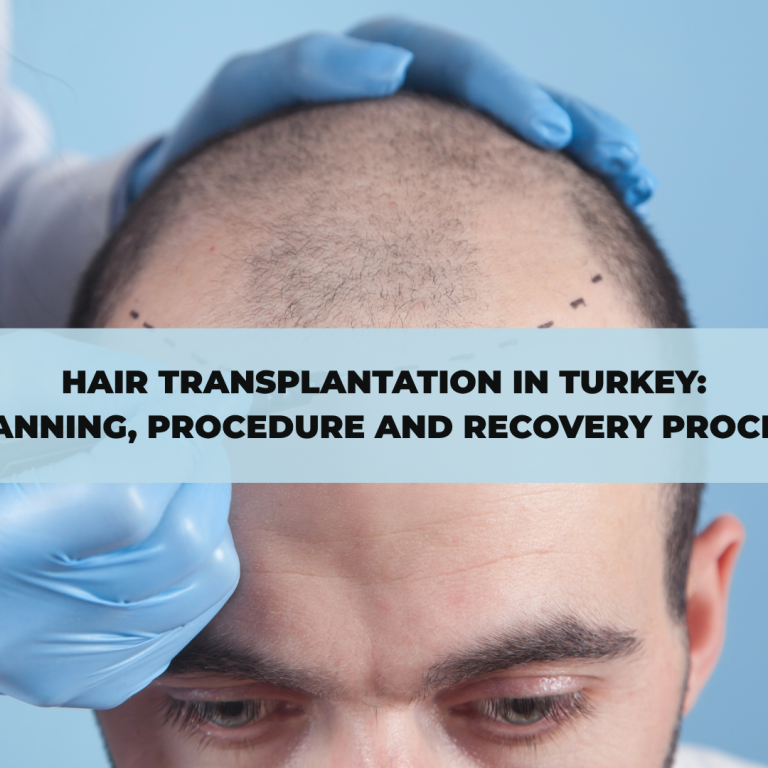 Hair Transplantation in Turkey: Planning, Procedure and Recovery Process