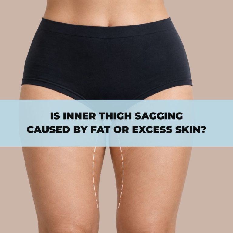 Is Inner Thigh Sagging Caused by Fat or Excess Skin?