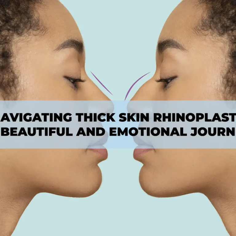 Patient undergoing thick skin rhinoplasty in Turkey, showcasing a transformative and emotional journey with expert aesthetic surgeons.